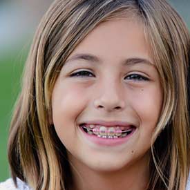 South Calgary Dentofacial Orthopedics | McKenzie Orthodontics in ...
